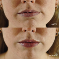 5punto5 Lip Booster Efecto Repulpante 15 Ml