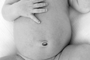 Cordón umbilical en bebé