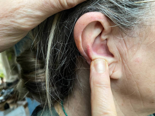 Granos en la oreja