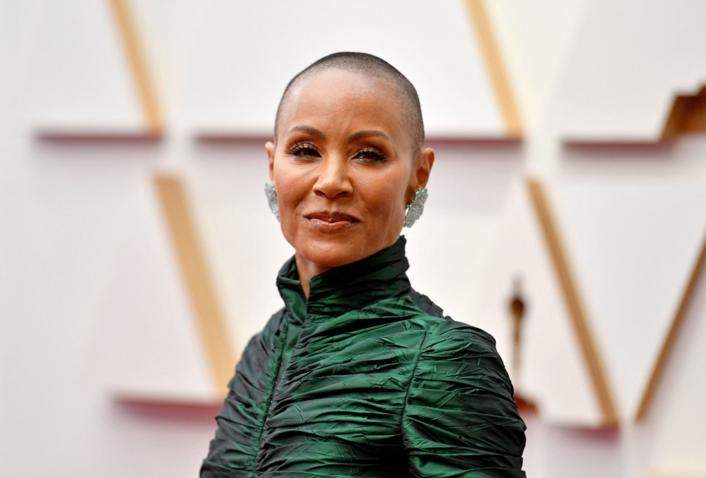 Alopecia Mujer Will