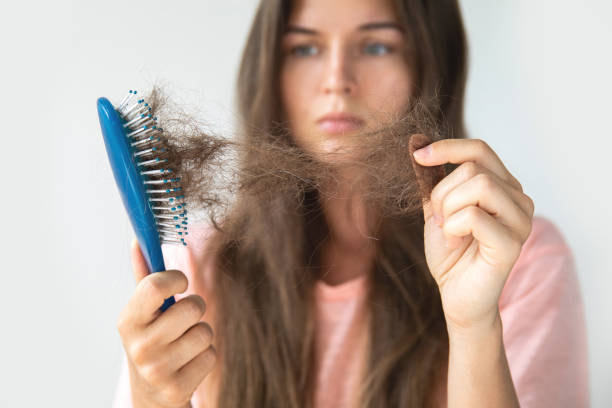 Cómo evitar la caída del pelo