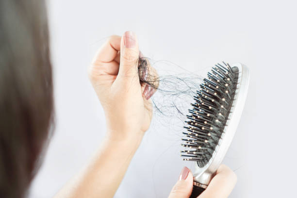 pelo caido