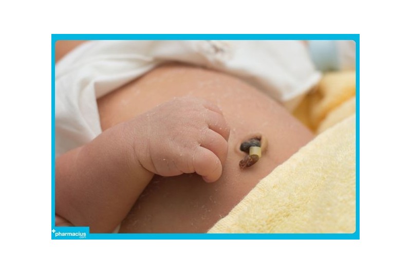¡No Tengas Miedo! Descubre el Método para Cuidar el Cordón Umbilical de tu Bebé Sin Complicaciones